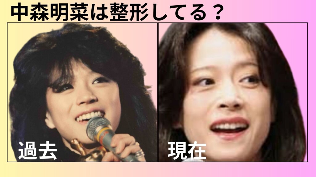 中森明菜は整形している?